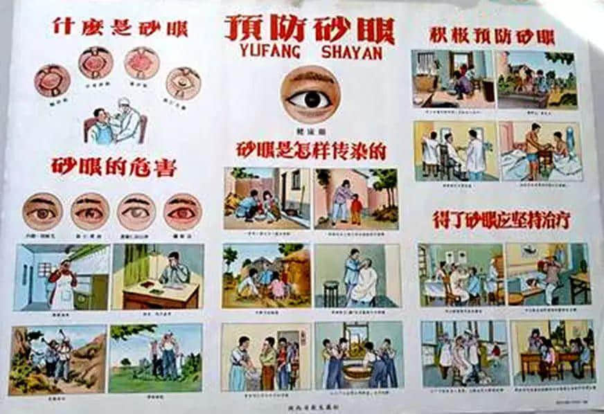 驚悚：六十年前我們怎樣治砂眼？