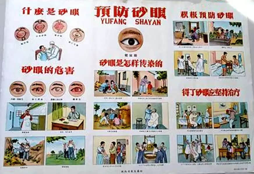驚悚：六十年前我們怎樣治砂眼？