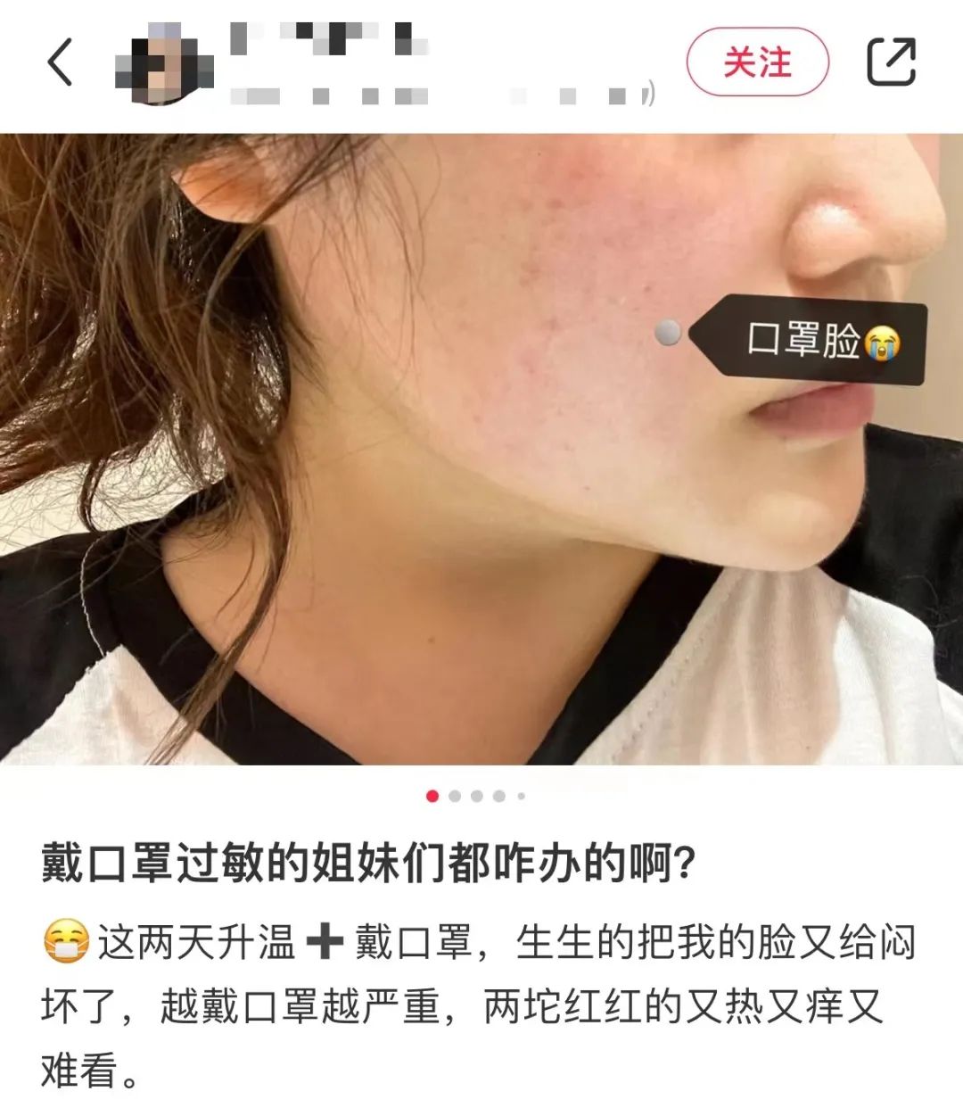 戴了三年的口罩，你還摘得下來嗎？